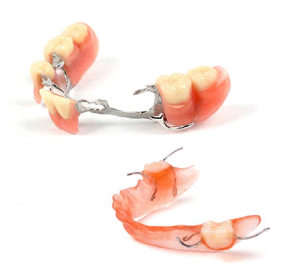 دندانسازي منطقه 4
