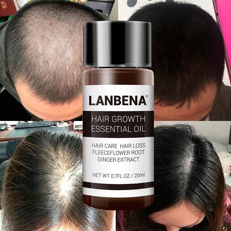 روغن رشد مو و ریش لانبنا LANBENA